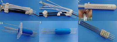 Analysis of Applicator Insertion Related Acute Side Effects for Cervical Cancer Treated With Brachytherapy